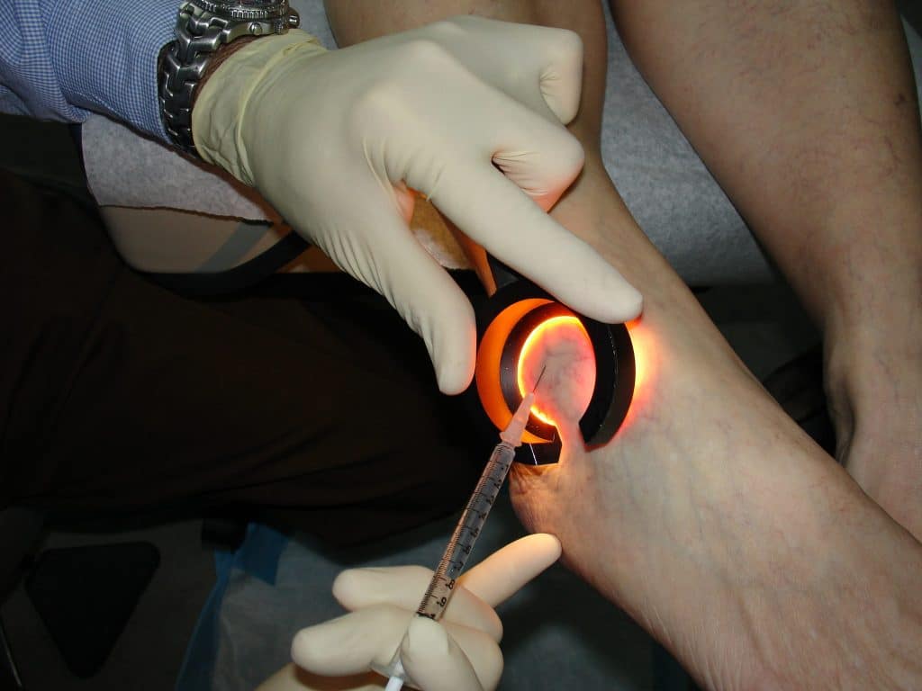 Sclero Light 2